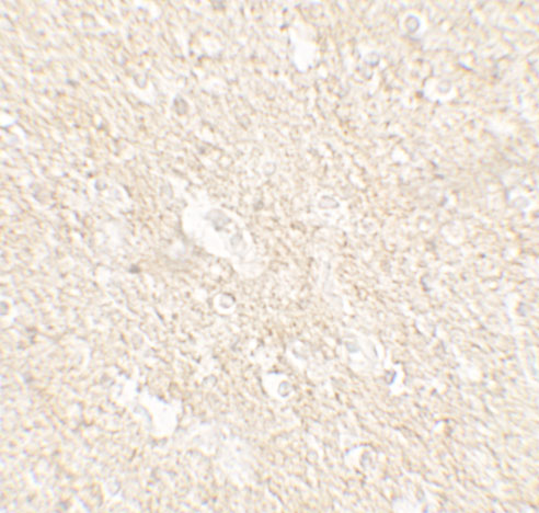 a11671 1 appbp2 primary antibodies ihc testing 2