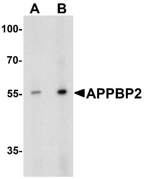 a11671 1 appbp2 primary antibodies wb testing 1