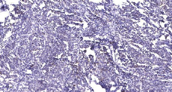 Immunohistochemical analysis of paraffin-embedded human Breast cancer