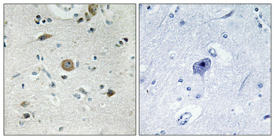 Immunohistochemistry validation of ACOT4 using Anti-Acyl-coenzyme A thioesterase 4 ACOT4 Antibody (A11674-1)