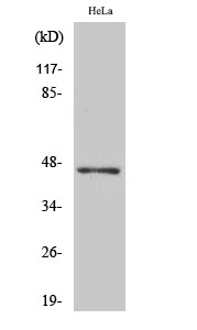 Western blotting validation for Anti-Acyl-coenzyme A thioesterase 4 ACOT4 Antibody A11674-1
Western Blot (WB) analysis of specific cells using ACOT4 polyclonal antibody