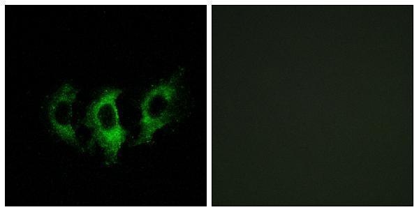 Immunofluorescence analysis of A549 cells, using GFM2 Antibody