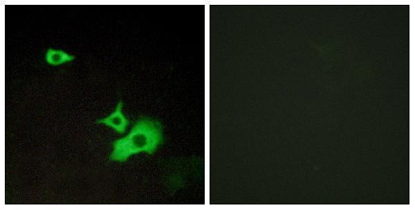 Immunofluorescence analysis of LOVO cells, using ETBR2 Antibody