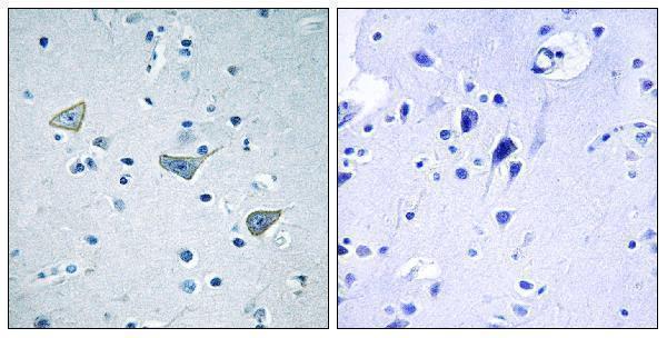 a11699 gpr158 primary antibodies ihc testing 4