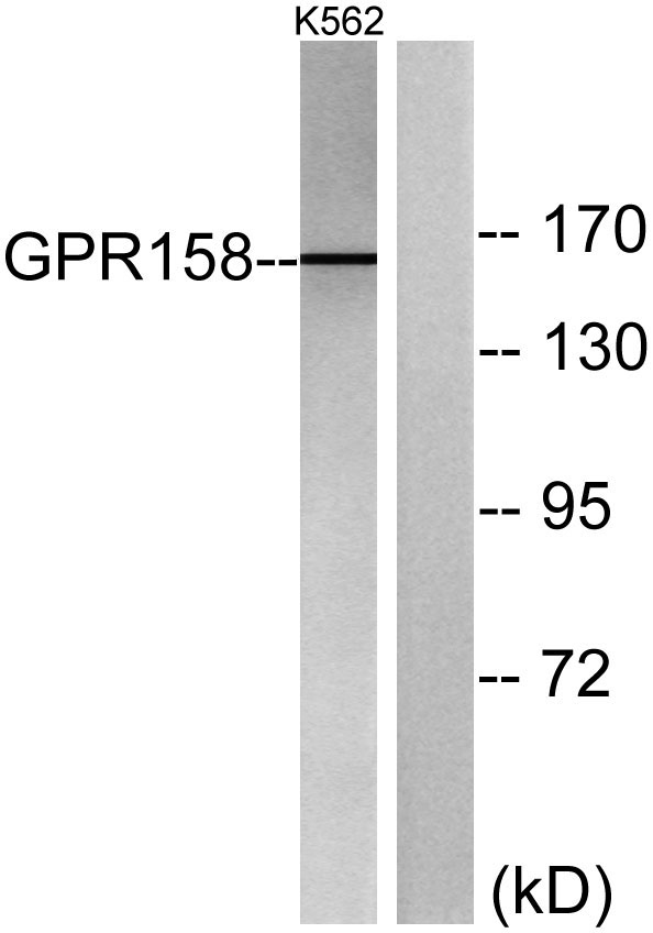 Western blot analysis of lysates from K562 cells, using GPR158 Antibody
