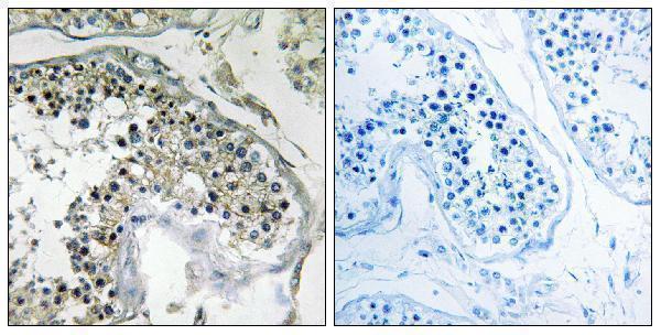 a11702 ppp1r1c primary antibodies ihc testing 1