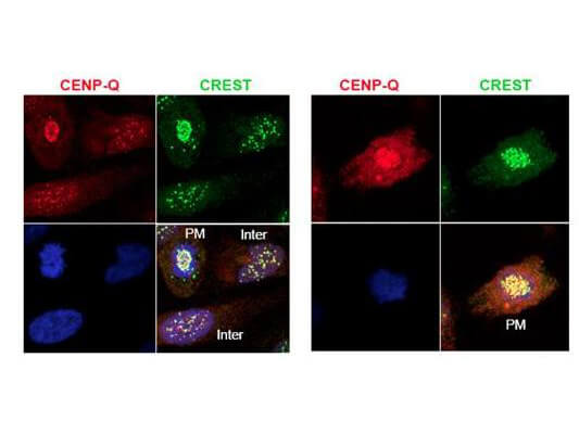 Immunofluorescence microscopy using Boster's protein A purified anti-CENP-Q antibody shows detection of endogenous CENP-Q in HeLa whole cell lysate