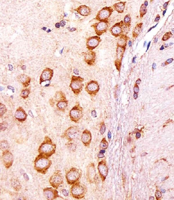 Immunohistochemical analysis of paraffin-embedded R
