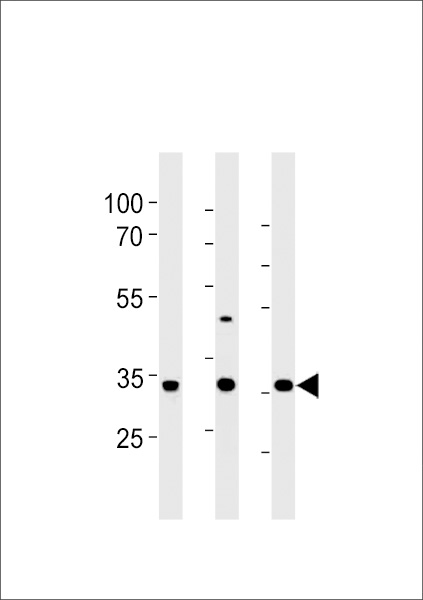 RAT Cgref1 Antibody (C-term) western blot analysis in rat liver,stomach and testis tissue lysates (35ug/lane)