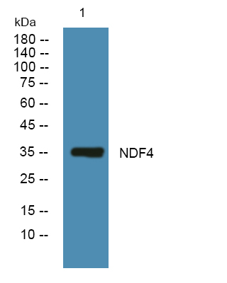 Western blot analysis of lysates from HCT116 cells, primary antibody was diluted at 1:1000, 4°over night
