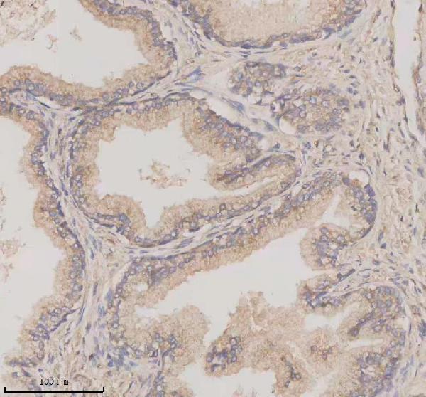 a11712 1 tmem175 primary antibodies ihc testing 1