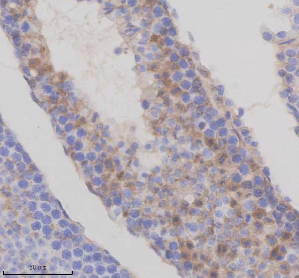 a11712 1 tmem175 primary antibodies ihc testing 2