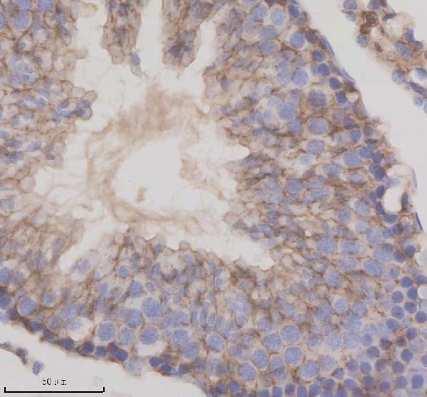 a11712 1 tmem175 primary antibodies ihc testing 3