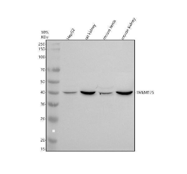 a11712 1 tmem175 primary antibodies wb testing 1