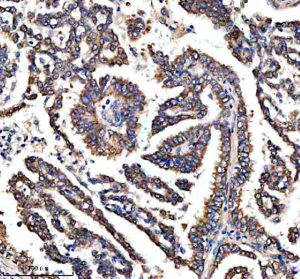  IHC analysis of RASAL3 using anti-RASAL3 antibody (A11713-1)