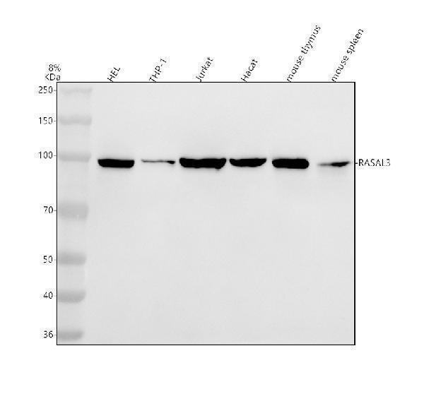  Western blot analysis of RASAL3 using anti-RASAL3 antibody (A11713-1)