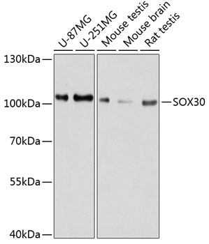 a11717 sox30 primary antiboties wb testing 1