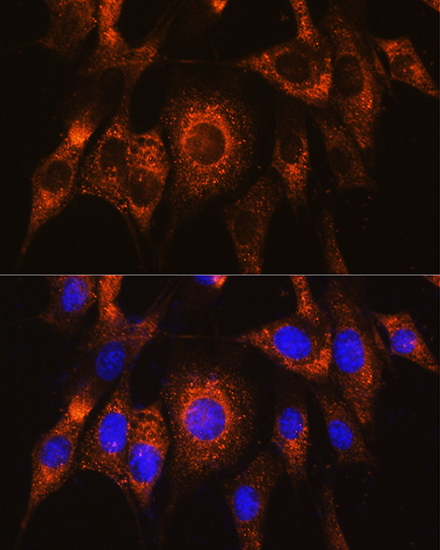Immunofluorescence analysis of NIH/3T3 cells using UBAC2 Rabbit pAb  at dilution of 1:100