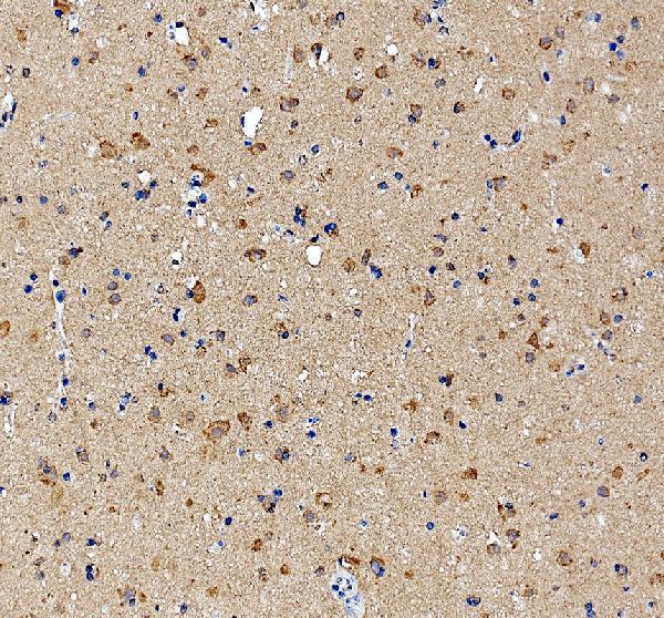 a11721 1 epc2 primary antibodies ihc testing 1
