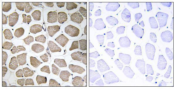 Immunohistochemistry analysis of paraffin-embedded human skeletal muscle tissue, using MOT12 Antibody