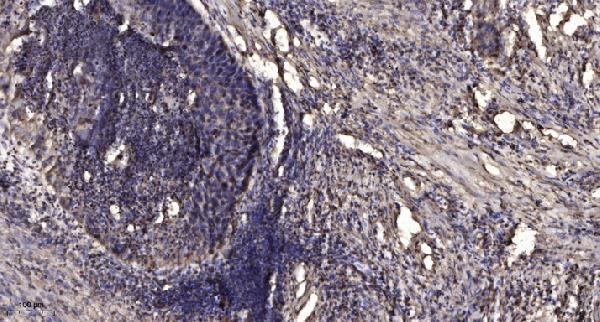 a11729 agpat4 primary antibodies ihc testing 1