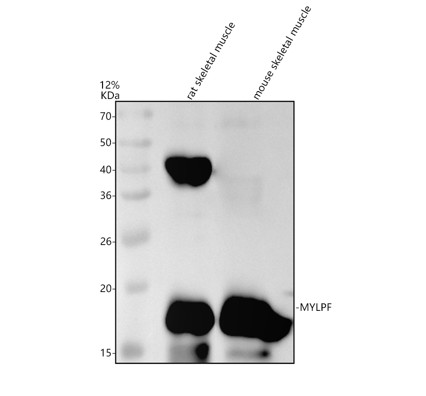 Western blot analysis of MYLPF/MYL11 using anti-MYLPF/MYL11 antibody (A11730-1)