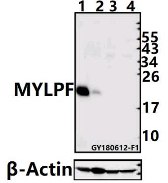 Western blot (WB) analysis of MYLPF (D23) pAb at 1:500 dilution
Lane1:The Muscle tissue lysate of Mouse(40ug)
Lane2:The Muscle tissue lysate of Rat(40ug)
Lane3:LOVO whole cell lysate(40ug)
Lane4:H1792 whole cell lysate(40ug)