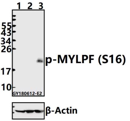 a11730s16 mylpf primary antiboties wb testing 1