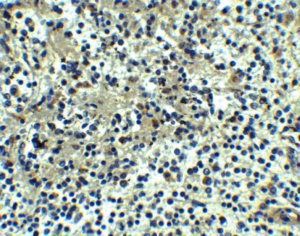 Immunohistochemistry of DEPDC1B in human spleen tissue with DEPDC1B antibody at 5 μg/ml