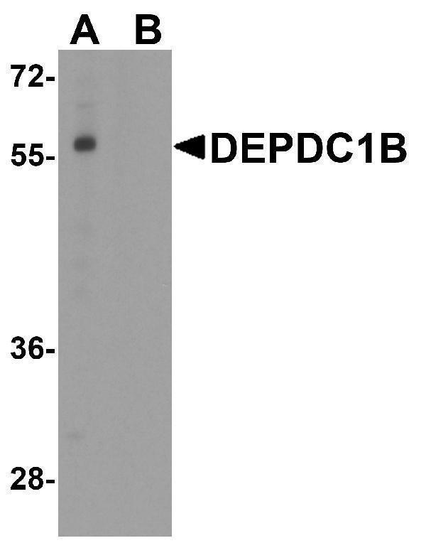 Western blot analysis of DEPDC1B in K562 cell lysate with DEPDC1B antibody at 1 μg/ml in (A) the absence and (B) the presence of blocking peptide