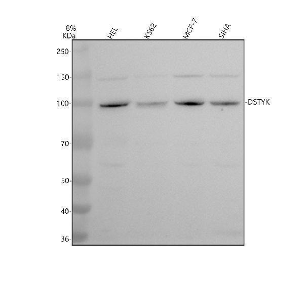 Western blot analysis of DSTYK using anti-DSTYK antibody (A11737-1)