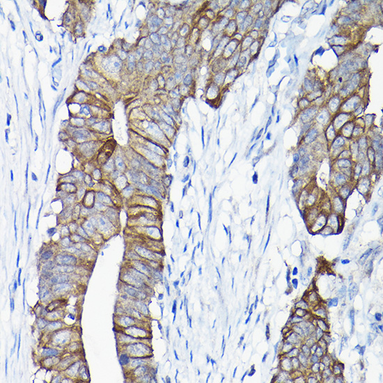 a11738 anxa13 primary antiboties ihc testing 2