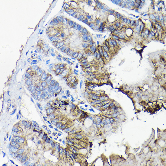 a11738 anxa13 primary antiboties ihc testing 3