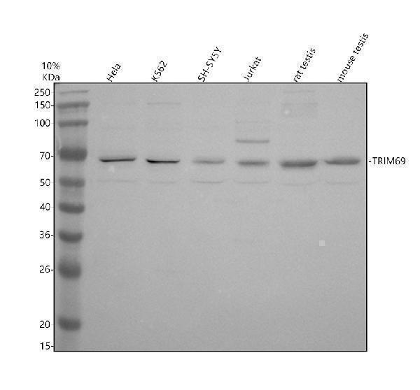 Western blot analysis of TRIM69 using anti-TRIM69 antibody (A11739-2)