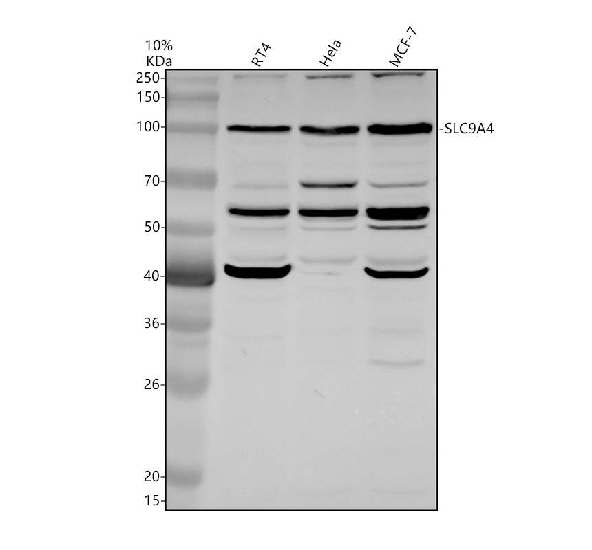 Western blot analysis of SLC9A4 using anti-SLC9A4 antibody (A11747-1)