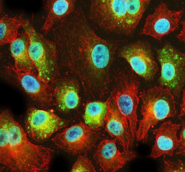  IF analysis of PFDN2 using anti-PFDN2 antibody (A11752-1) and anti-Beta Tubulin antibody (M01857-3)