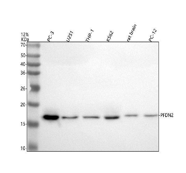  Western blot analysis of PFDN2 using anti-PFDN2 antibody (A11752-1)