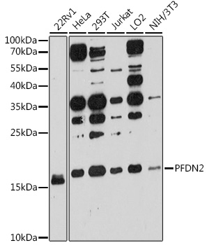 a11752 pfdn2 primary antiboties wb testing 1