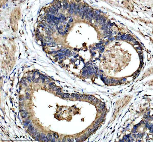 a11753 1 esf1 primary antibodies ihc testing 1