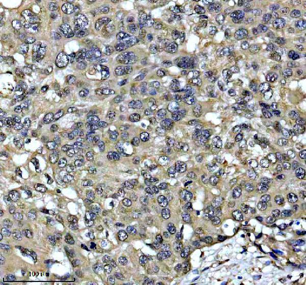 a11753 1 esf1 primary antibodies ihc testing 4