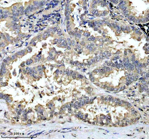 a11753 1 esf1 primary antibodies ihc testing 5