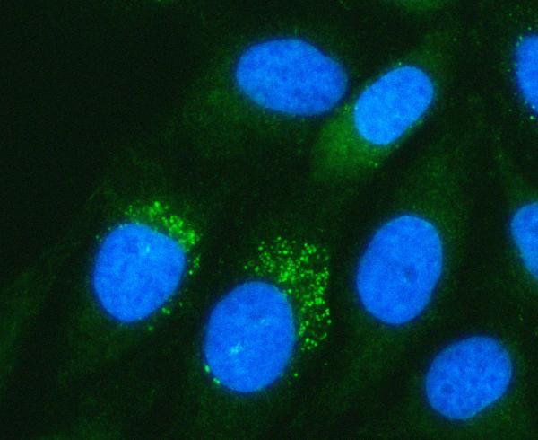 Figure 2. IF analysis of PADI3 using anti-PADI3 antibody (A11754-1). PADI3 was detected in an immunocytochemical section of HELA cells. Enzyme antigen retrieval was performed using IHC enzyme antigen retrieval reagent (AR0022) for 15 mins. The cells were blocked with 10% goat serum. And then incubated with 5 microg/mL rabbit anti-PADI3 Antibody (A11754-1) overnight at 4°C. DyLight®488 Conjugated Goat Anti-Rabbit IgG (BA1127) was used as secondary antibody at 1:500 dilution and incubated for 30 minutes at 37°C. The section was counterstained with DAPI. Visualize using a fluorescence microscope and filter sets appropriate for the label used. Figure 2. IF analysis of PADI3 using anti-PADI3 antibody (A11754-1). PADI3 was detected in an immunocytochemical section of HELA cells. Enzyme antigen retrieval was performed using IHC enzyme antigen retrieval reagent (AR0022) for 15 mins. The cells were blocked with 10% goat serum. And then incubated with 5 microg/mL rabbit anti-PADI3 Antibody (A11754-1) overnight at 4°C. DyLight®488 Conjugated Goat Anti-Rabbit IgG (BA1127) was used as secondary antibody at 1:500 dilution and incubated for 30 minutes at 37°C. The section was counterstained with DAPI. Visualize using a fluorescence microscope and filter sets appropriate for the label used.