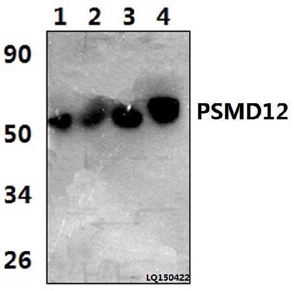 a11756 1 psmd12 primary antiboties wb testing 1
