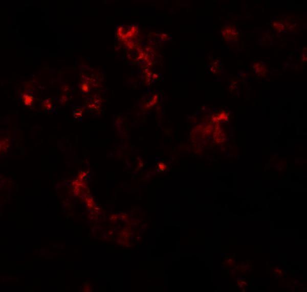 Immunofluorescence of TTYH2 in human kidney tissue with TTYH2 antibody at 20 μg/mL