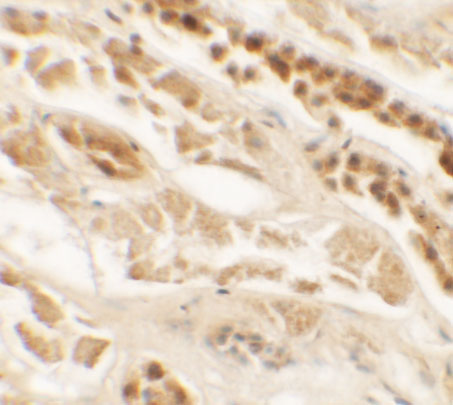 Immunohistochemistry of TTYH2 in human kidney tissue with TTYH2 antibody at 2