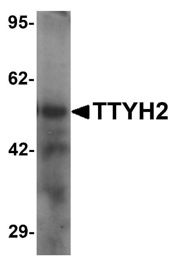 Western blot analysis of TTYH2 in human kidney tissue lysate with TTYH2 antibody at 1 μg/ml