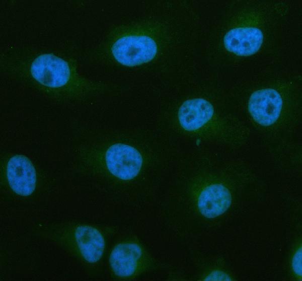 a11765 2 ccpg1 primary antibodies if testing 1
