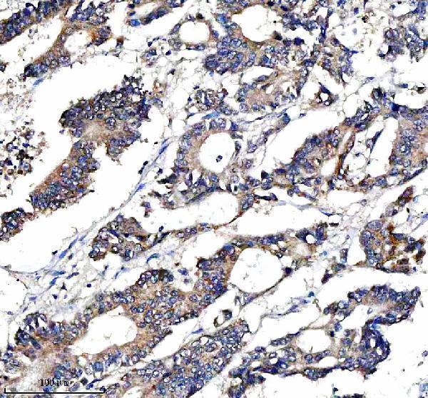 a11765 2 ccpg1 primary antibodies ihc testing 2