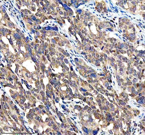 a11765 2 ccpg1 primary antibodies ihc testing 3