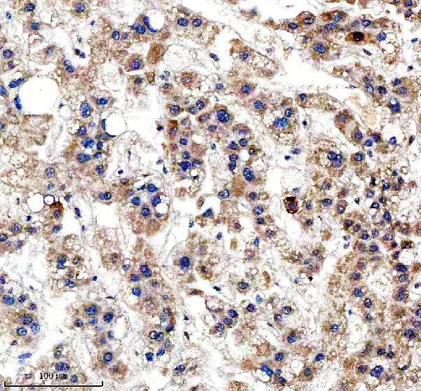 a11765 2 ccpg1 primary antibodies ihc testing 4